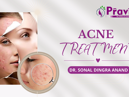 Acne Treatment: Effective Ways to Achieve Clear Skin