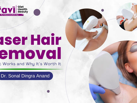 Laser Hair Removal: How It Works and Why It’s Worth It