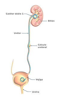 7 riñon tubo uretra cambios1.jpg