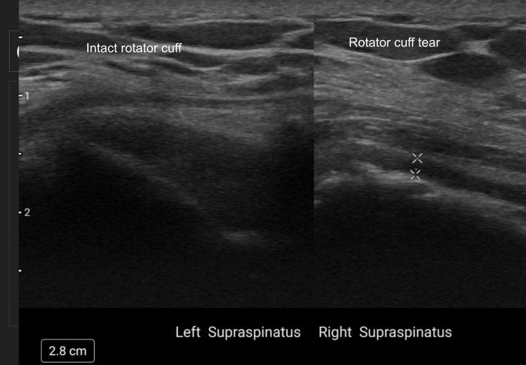 Close-up view of a Musculoskeletal Ultrasound equipment in a clinic