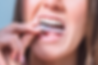 woman putting in here invisalign retainer