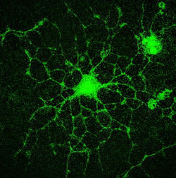 NRSN2-GFP transfection in primary neurons