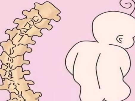 Tương lai của con trẻ sẽ ra sao nếu như bị gù lưng? Giải đáp và tư vấn