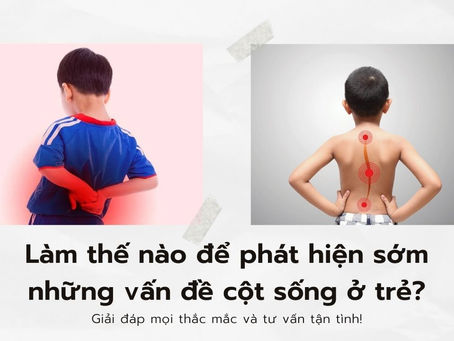 Làm thế nào để phát hiện sớm những vấn đề cột sống ở trẻ?