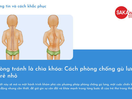 Phòng tránh là chìa khóa: Cách phòng chống gù lưng ở trẻ nhỏ