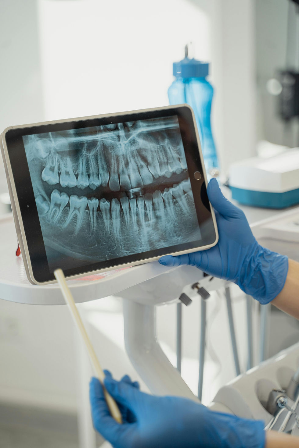a dentist holding up a dental x-ray on an iPad