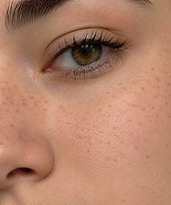 freckle tattoos
