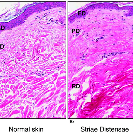 RÄÄGIME VENITUSARMIDEST..