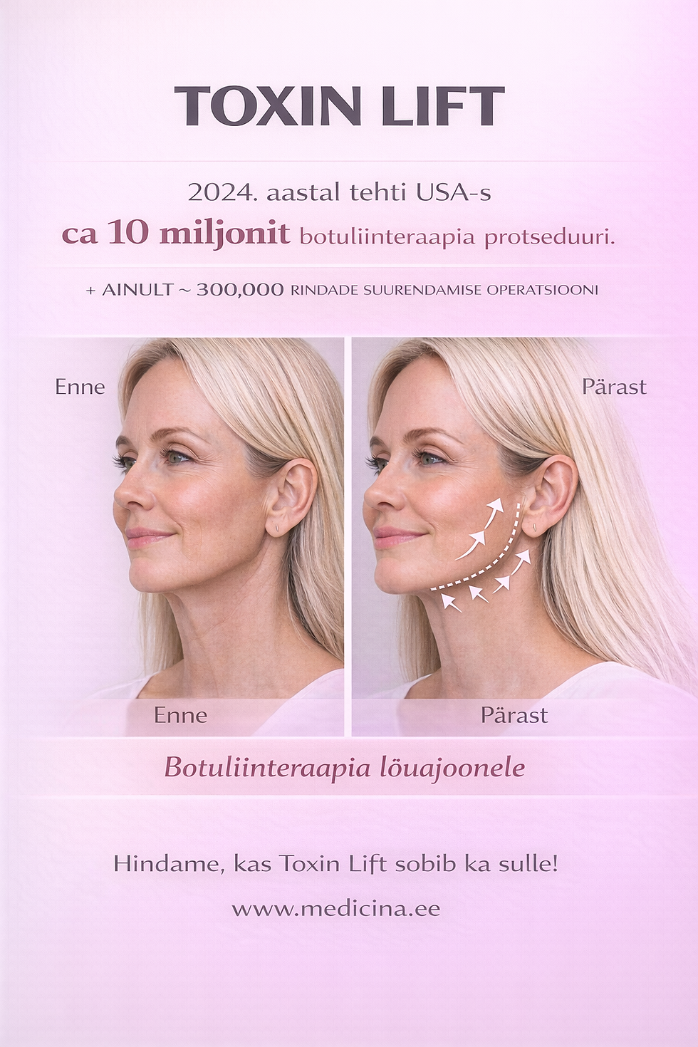 TOXIN LIFT näo alaosale