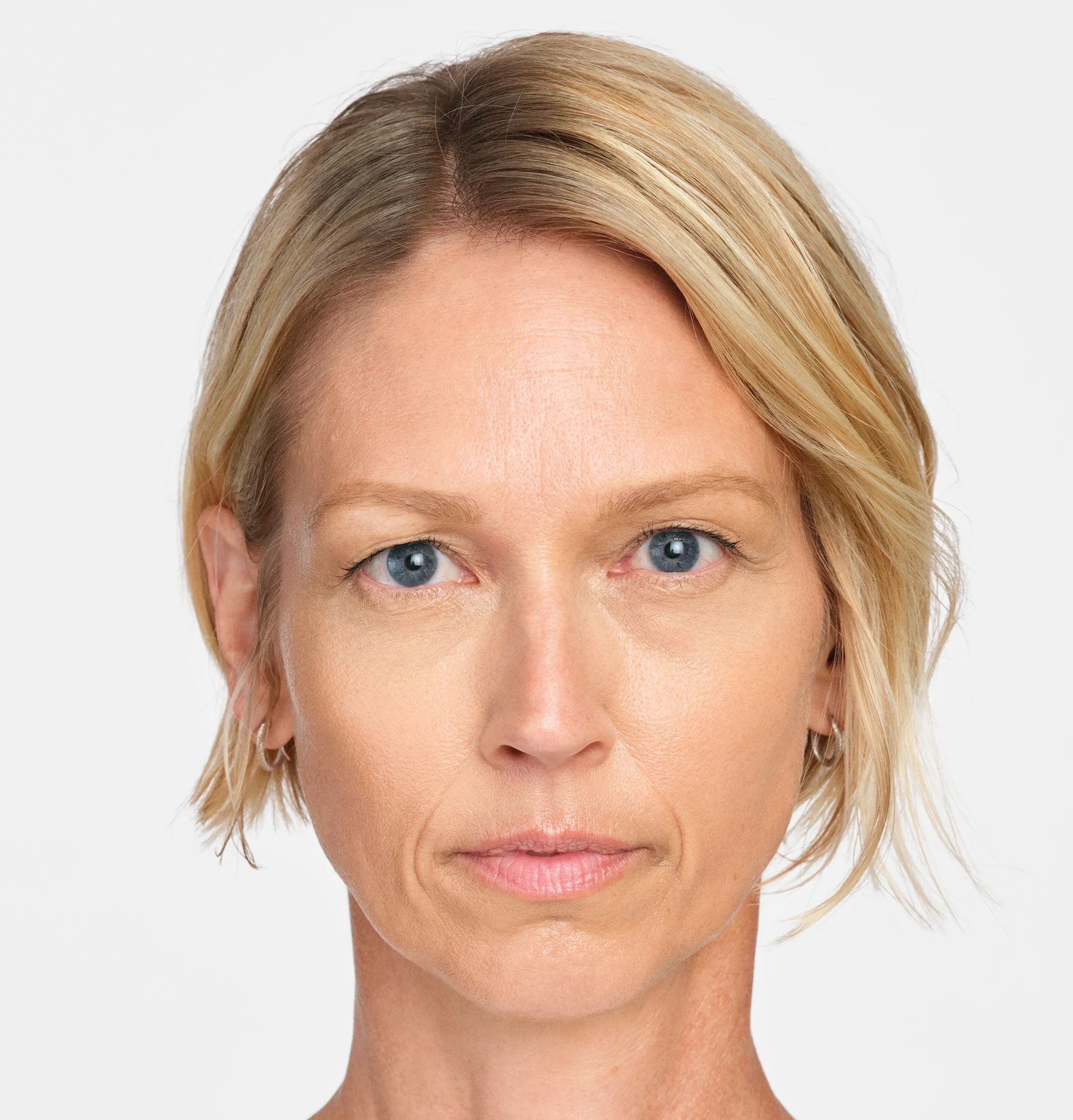 jackie-front-after-4wk_2x.webp