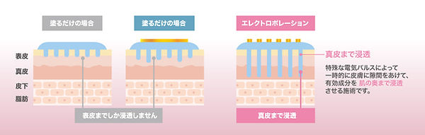 エレクトロポレーション.jpg