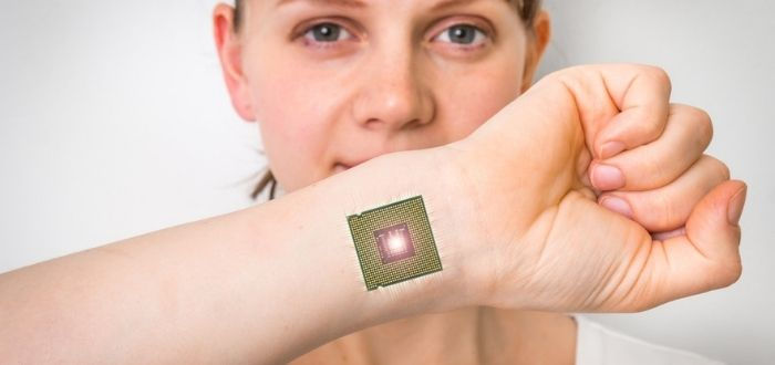 Implantes NFC