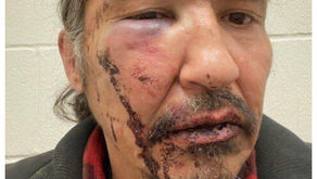Charges against Chief Allan Adam Withdrawn following his brutal RCMP arrest