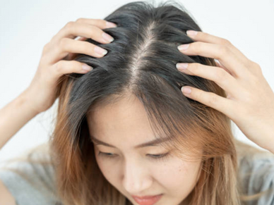 告別頭頂稀疏困擾!揭秘真相與ProHair活髮秘訣