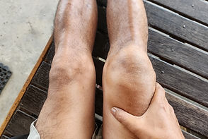 BrokenKneecap_img.jpg