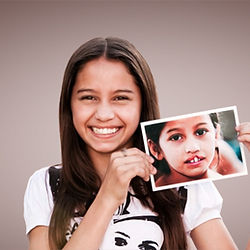 CLEFT LIP & CLEFT PLATE Sai Dental Care