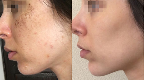 Lumecca testimonials