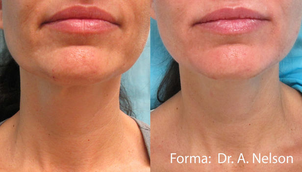 Forma at renaissance med spa