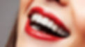 porcelain veneers.jpg