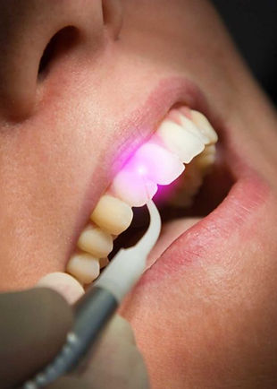 laser dentistry (1).jpg