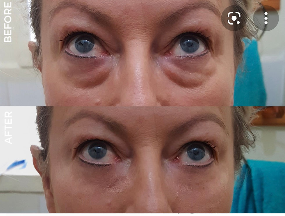Thumbnail: Instantly Ageless