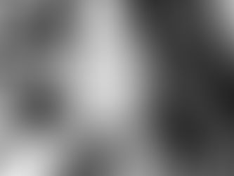 Progesterone: The Hormone That Isn’t Talked About Enough (and Why It Matters in Greenwood Village, CO)