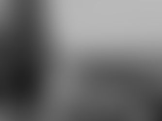 Masseter Botox in Portland, Oregon: Slimming and Jaw Clenching Relief