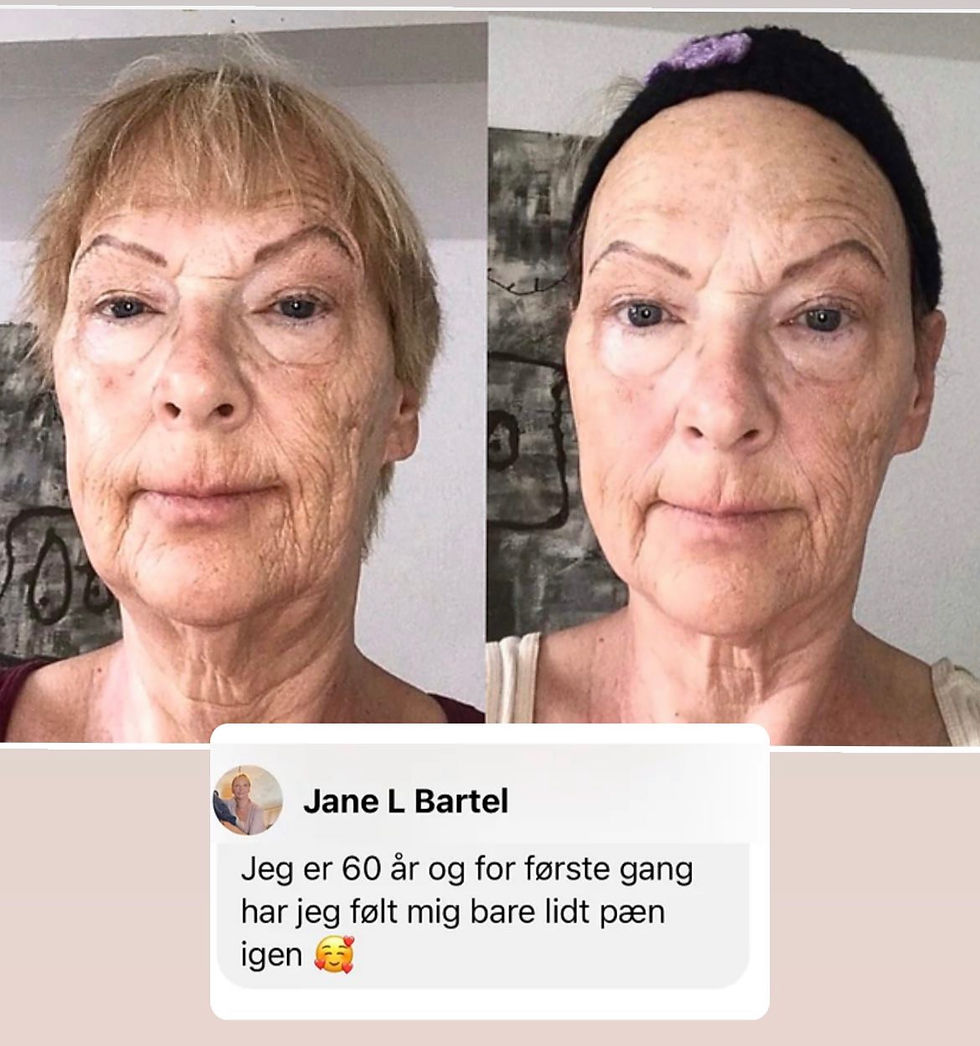 Før og efter FaceFit, Jane