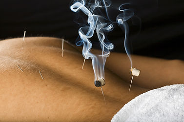 Moxibustion ( Chinese: 灸)