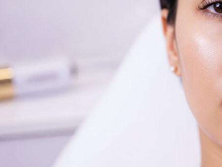 Microneedling for Acne Scars Essex: The Path to Smoother, Clearer Skin