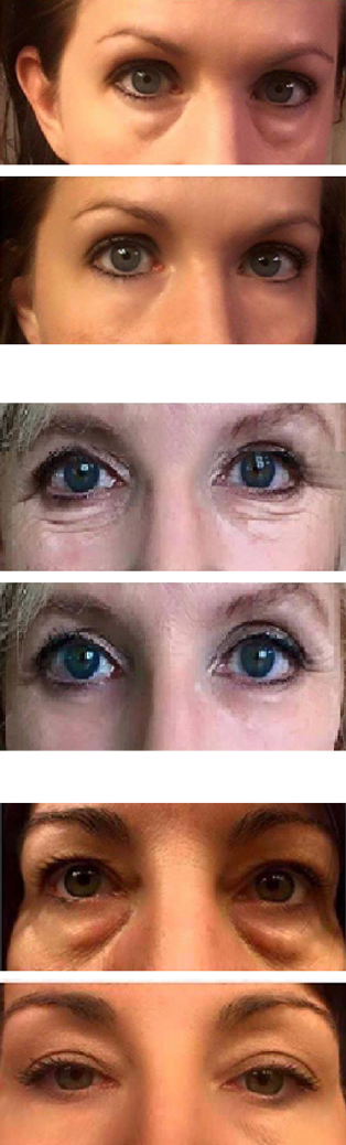 Instantly Ageless resultat