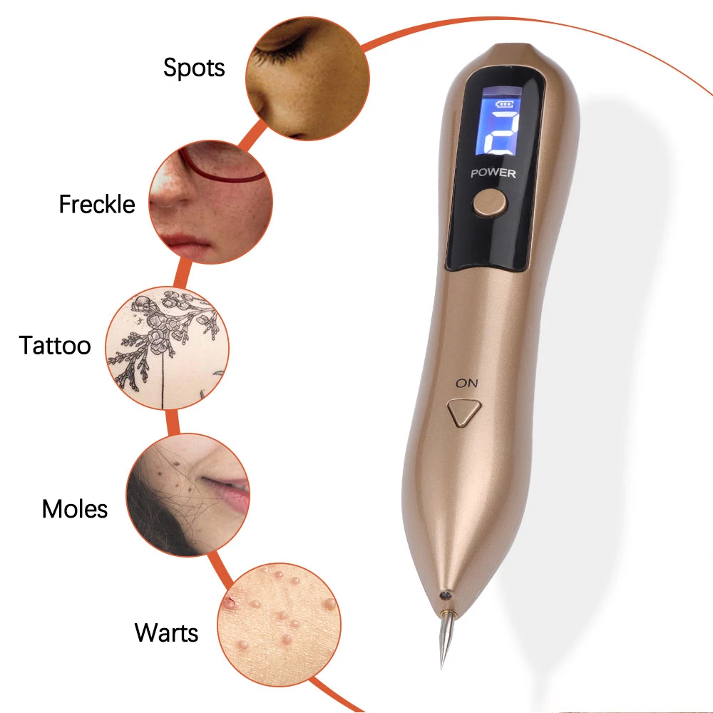 borttagning av leverfläckar och skin tags