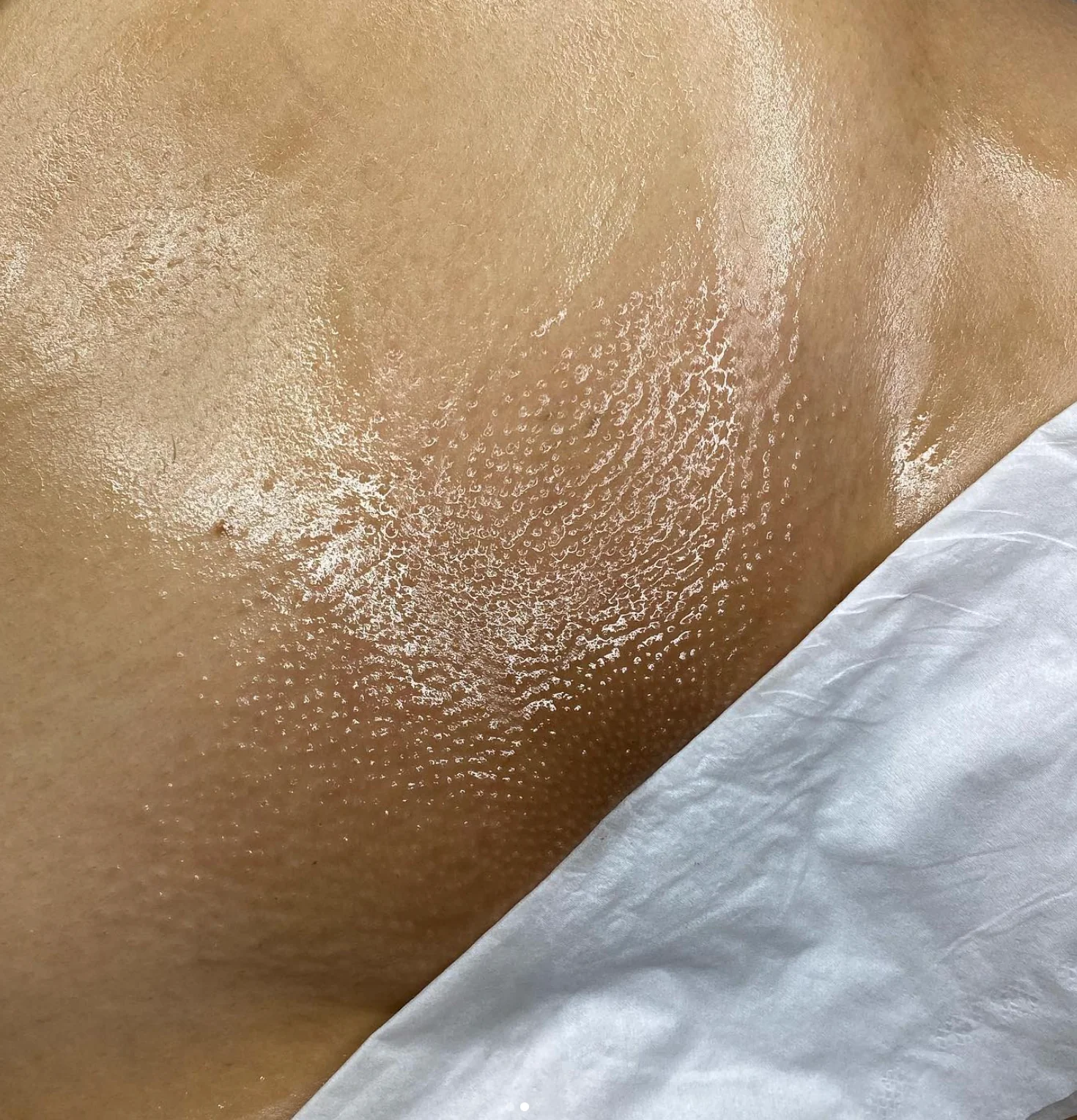 Brazilian_Waxing_Before_and_After_Photo_-_Wax_Junkie_-_Kimberly_Avalos_2022-03-19_at_1.46.