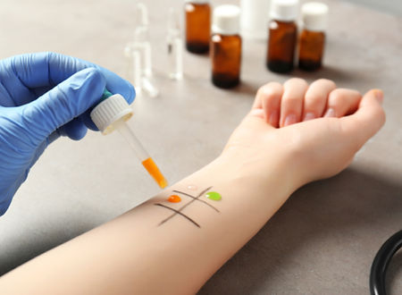 Skin Prick Test_edited.jpg