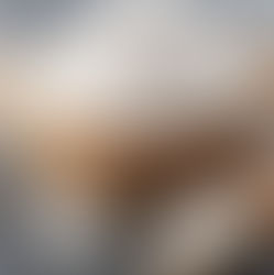 Sugar causes hair loss!