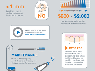 All About Veneers