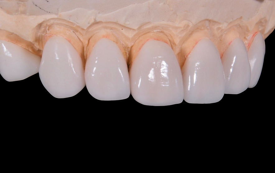 dental-2036945_1280.webp