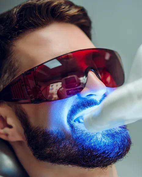 Teeth Whitening.webp