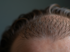 The Importance of Deep Cleansing for Your Scalp - Scalp Cleansing Benefits