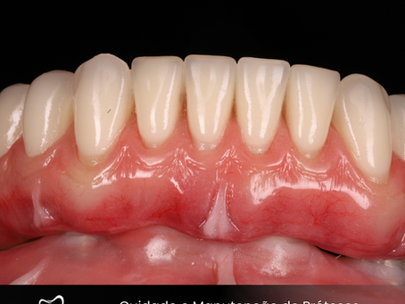 Cuidado e Manutenção de Próteses Dentárias: Dicas Essenciais