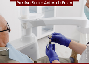 Implantes Dentários: O Que Você