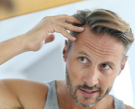 male-hair-loss.jpg