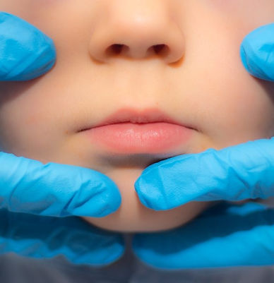 imgi_186_motricidad-orofacial-1024x683.jpg