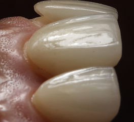 Carillas 2_edited.jpg