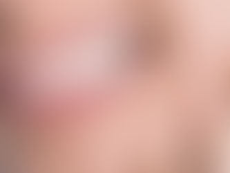 ¿Por Qué Me Duele un Diente? Descubriendo las Razones Detrás del Dolor Dental