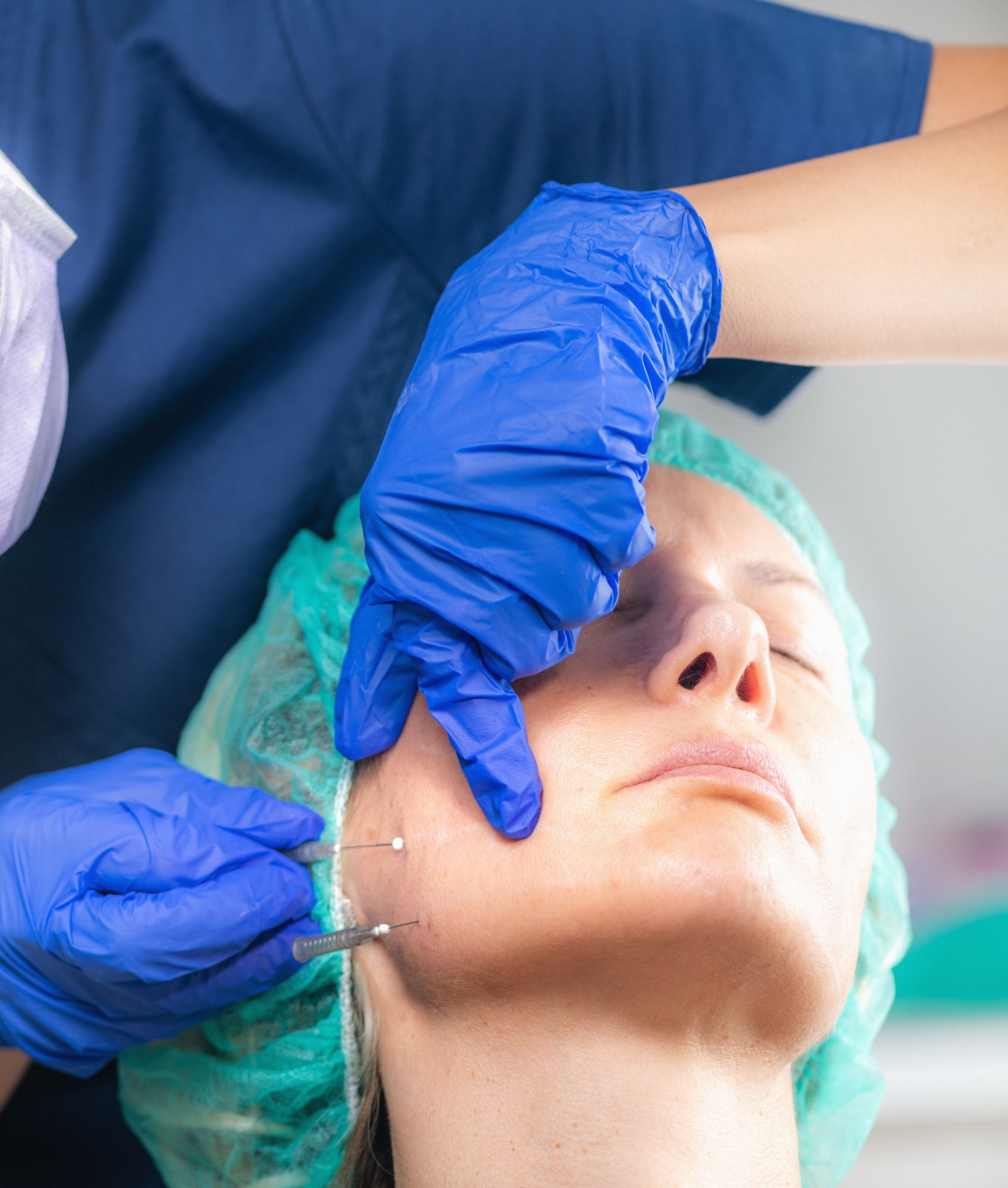 Hilos revitalizantes 30