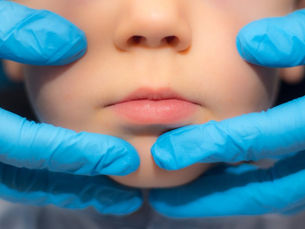 ¿Dientes de leche con caries?, Por qué no debemos dejarlos sin tratamiento a la esperar de que se caigan