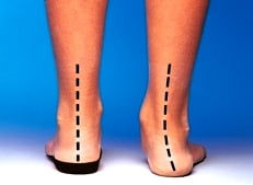 sever's disease treatment rehab exercises