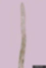 Pine Wood Nematode Adult. Photo by J. Eisenback