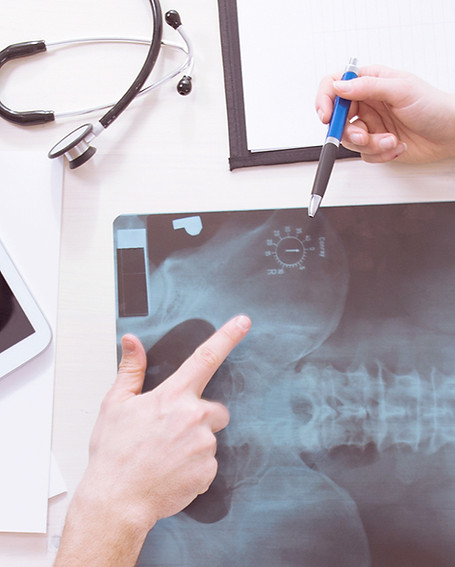 X-Ray Results_edited.jpg